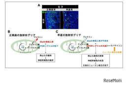 早産児の神経発達予後改善に新知見、名古屋市立大ら研究