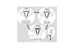 月経痛と過多月経の緩和に効果的なピル。10代でピルを服用するメリットは？【産婦人科医に聞く わたしとカラダの選択肢  #９】