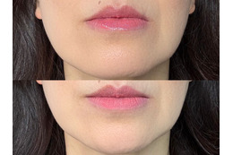 40・50代が老けて見えるのはリップの色のせい？オバ見えリップの特徴【2025年度ベスト記事セレクション】 画像