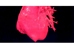 18歳で突然死した選手、「検出不能」な心臓の奇形があった？ 画像