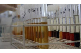 「シティで働いている」という医師、ドーピング違反で告発される 画像