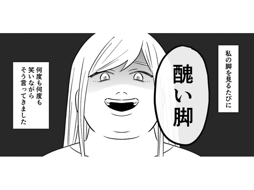 「醜い脚」母は私の脚を見る度、笑いながら嫌味を繰り返【毒親に育てられました２ #18】