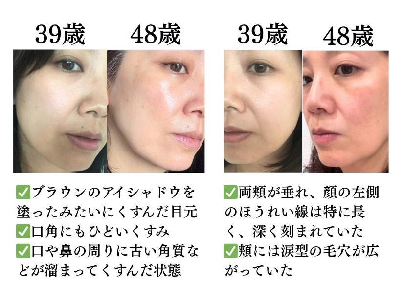肌年齢マイナス14歳美容のプロが本当に続けて良かった美容法とは？
