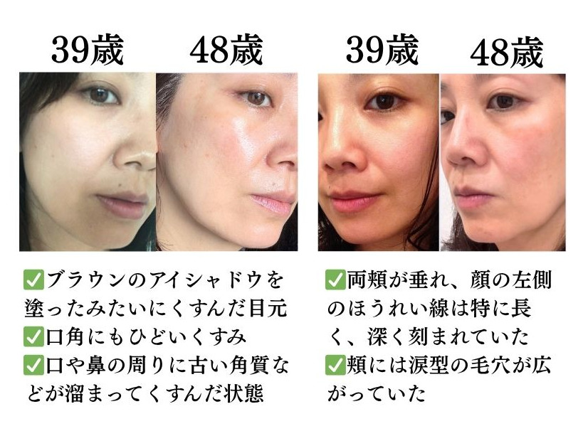 心から老けていた美容のプロが肌年齢マイナス14歳になるまでやめた美容。やめてよかった第一位は？