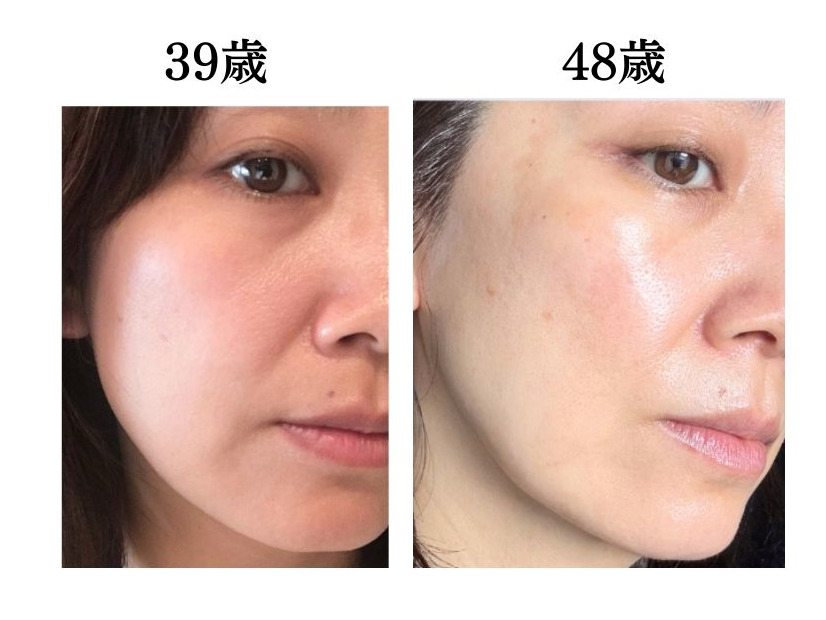 頭や首、肩のコリも老け肌につながっていた。肌年齢マイナス14歳美容のプロがやめたこととは？