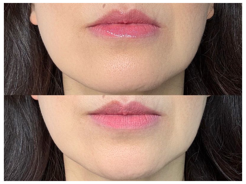 40・50代が老けて見えるのはリップの色のせい？オバ見えリップの特徴【2025年度ベスト記事セレクション】