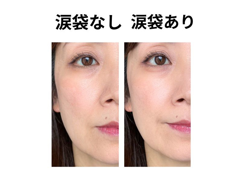 40・50代に涙袋メイクはアリか、ナシか。49歳美容のプロの結論