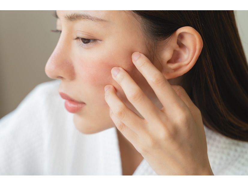花粉の肌荒れを加速する、NGお手入れとは。40代50代は侮っていると長期化する恐れも……！