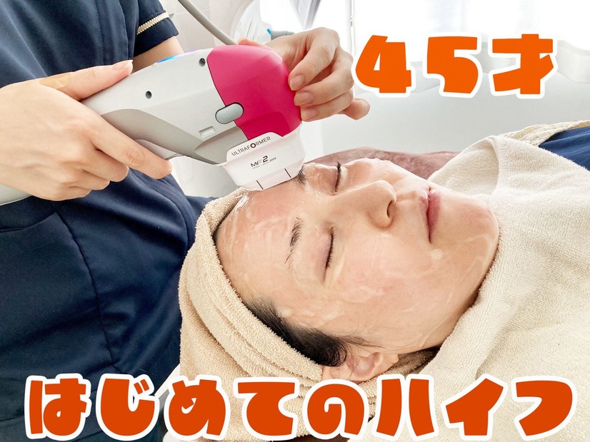 【美容】45歳、はじめてのハイフ。たるんだ顔はどれだけ変わるのか！？