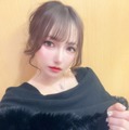 “顔全パーツ整形”現役アイドル・MiRichan、300万で脂肪吸引 術後の痛み・苦労明かす 画像