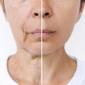 「電車の窓に映った自分にゾッ！」実は「たるみ」を加速させるNG行動とは【50代美白のカリスマ・さきめぐ先生に聞いた】 画像