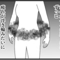 「更年期のホルモン補充治療」ってどんな感じ？ 受けてみて、驚きの結果はいかに⁉【100人の更年期 #14】 画像