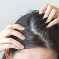 40代が猛暑でベタついた頭皮を放置すると「オバ見え」一直線！？「もしかして加齢臭？」ニオイやかゆみ、抜け毛など更年期世代の頭皮トラブルが招く「避けたい事態」と原因、対処法とは？ 画像