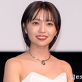 大原優乃、親知らず抜歯後の腫れた顔公開「根っこは3本あって大物でした」 画像