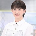 フジ宮司愛海アナ、鼻中隔湾曲症の手術を受けたことを報告 術後の姿公開に「痛々しい」「お大事に」の声 画像