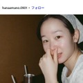 「ダウンタイム」天野はな「beforeもafterも特殊メイクです」整形役秘話投稿に反響「本物の整形かと思った」「リアルすぎる」の声 画像