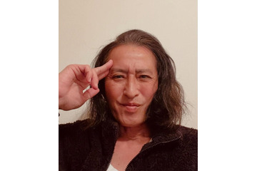 元光GENJI大沢樹生、人生初の交通事故＆1週間後に自転車で転倒 痛々しい傷跡残る近影公開 画像