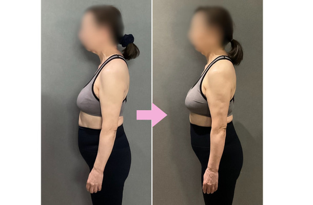 70歳でも「３カ月で驚くほど変わった」。ほぐすだけで「お腹がスッキリ」！年齢とともに固くなりがちなパーツは【鬼軍曹ゆか様ダイエット】