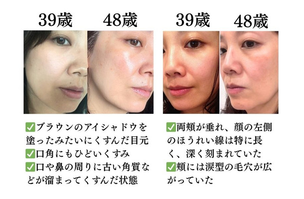 「ほうれい線の原因が判明！」やめたら「巻き戻し美容」が進んだ。40代からの「老け見え」を防ぐ生活習慣とは？