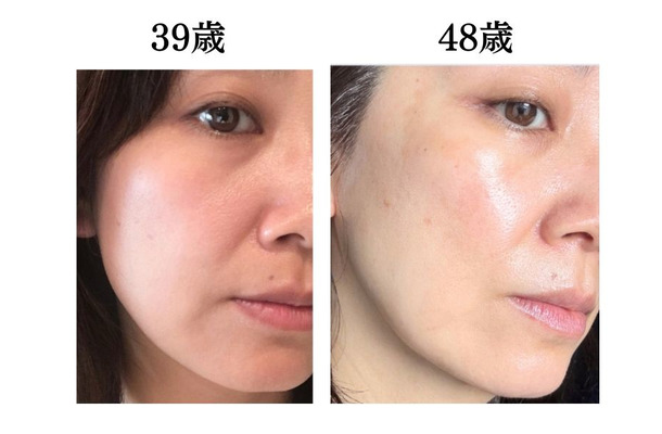 頭や首、肩のコリも老け肌につながっていた。肌年齢マイナス14歳美容のプロがやめたこととは？