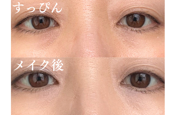 どんなに塗っても消えない。40代の黒クマがメイクでカバーできない理由