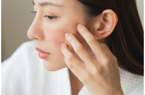 花粉の肌荒れを加速する、NGお手入れとは。40代50代は侮っていると長期化する恐れも……!