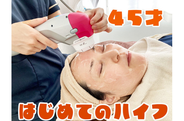 【美容】45歳、はじめてのハイフ。たるんだ顔はどれだけ変わるのか！？