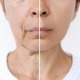 「電車の窓に映った自分にゾッ！」実は「たるみ」を加速させるNG行動とは【50代美白のカリスマ・さきめぐ先生に聞いた】