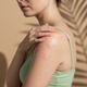 大人になってから発症・再燃することも。40代・50代のアトピー性皮膚炎【専門家監修】