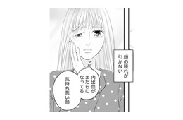 顔だけが取り柄の私なのに腫れが引かない。これからどうすればいいの？【かつて女の子だった人たちへ #32】