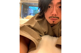 カマたく、人中短縮＆眉下切開の整形報告 ダウンタイム中の自撮りも公開「マジこいつ誰？」「顔が腫れてめちゃくちゃおもろい」