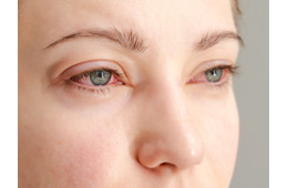 「目のかゆみ」がつらすぎる…その花粉症、実は“肝の疲れ”かも？漢方の専門家がおすすめする「酸味」と「苦味」の食べ物