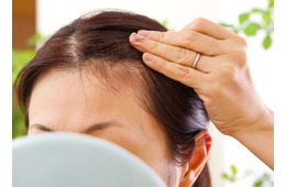 「抜け毛」が増えるのは、季節の変わり目のせい？ストレスのせい？「育毛鍼灸師が教える「異常信号」と、髪を生やすためにできること