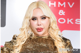 “整形総額1億円超え”アレン様、月の美容費は「140〜150万円」唇ヒアルロン酸注射事情もぶっちゃけ「針穴から漏れ出るくらい…」
