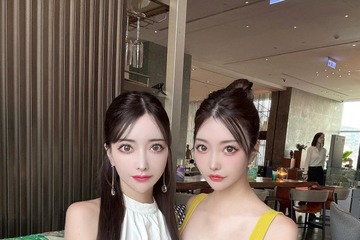 双子モデルの吉川ちえ＆ちか、“1人2000万”顔面整形のきっかけは顎 最近の高額治療事情明かす 画像