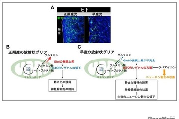 早産児の神経発達予後改善に新知見、名古屋市立大ら研究 画像