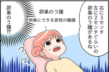 「卵巣のう種がある⁉」「帝王切開の傷が開いてる!?」しかも、副作用で更年期症状が？【100人の更年期 #49】 画像