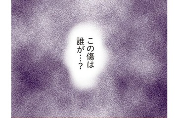 車についてしまったキズ。いったい誰がつけたんだろう。あれ？子どもたちが手に持っているものって……【犯人は私だけが知っている～母たちは静観する～ #５】 画像