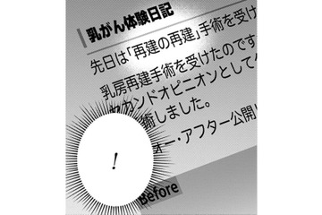 「再建の再建？」その手があったのか！自分の胸に希望が湧いてきた！【Dressing　美容外科医　森野まりあ #８】 画像
