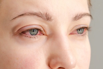 「目のかゆみ」がつらすぎる…その花粉症、実は“肝の疲れ”かも？漢方の専門家がおすすめする「酸味」と「苦味」の食べ物 画像