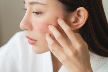 花粉の肌荒れを加速する、NGお手入れとは。40代50代は侮っていると長期化する恐れも……！ 画像