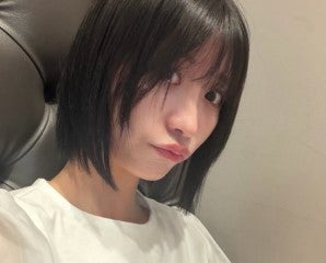 元SDN48メンバー、肝臓に腫瘍「しかも4つも」医師からの注意も明かす 画像