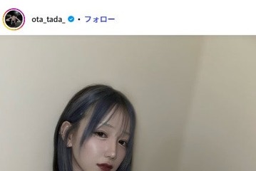 「月曜から夜ふかし」多田さん「顎の感覚が20パーくらい戻ってきました」ダウンタイム4日目の姿披露「大変そうだけど頑張って」「完成が楽しみ」の声 画像