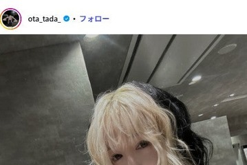 「月曜から夜ふかし」多田さん「口角を上げるのはできるようになりました」整形DT1ヶ月2週間後の様子公開「時系列を追った発信参考になる」「よくなってきてる」の声 画像