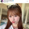 「首が真っ赤」モー娘。卒業控える生田衣梨奈、グアムでの日焼けSHOTにファン驚き「めっちゃ焼けてる！！」 画像