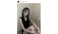 「月曜から夜ふかし」多田さん、整形手術後の腫れ上がった顔面公開「顔腫れすぎてフェイスバンドつけれない」 画像
