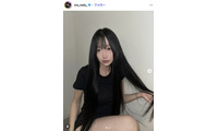 「月曜から夜ふかし」多田さん「残り10日で術後1ヶ月です」ノーマルカメラで整形DTの経過報告「強さに感動」「早く良くなりますように」と反響 画像