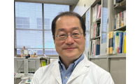 【恐怖】夏の体臭の犯人は「トイレのあのニオイ」と同じ！？特に注意すべき体の部位とは【皮膚ガス研究の第一人者が解説】 画像