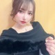 “顔全パーツ整形”現役アイドル・MiRichan、300万で脂肪吸引 術後の痛み・苦労明かす 画像